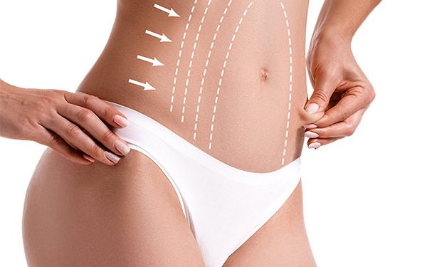Abdominoplasty (Tummy Tuck)