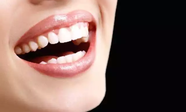 Dental Aesthetics