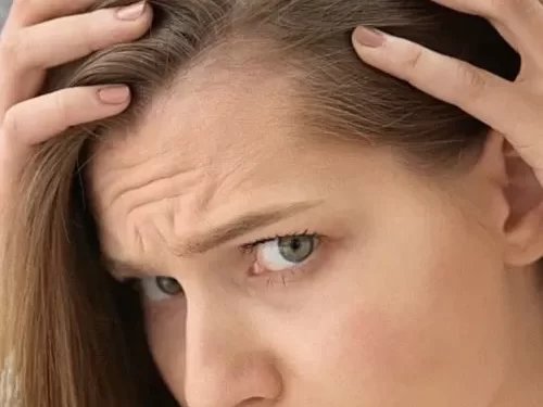 Hair Transplantation